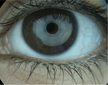 tmh eye img desk